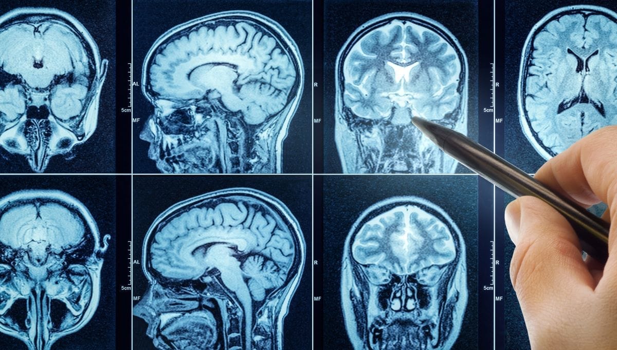 Brain - welltica.dk - Vejen til et bedre liv