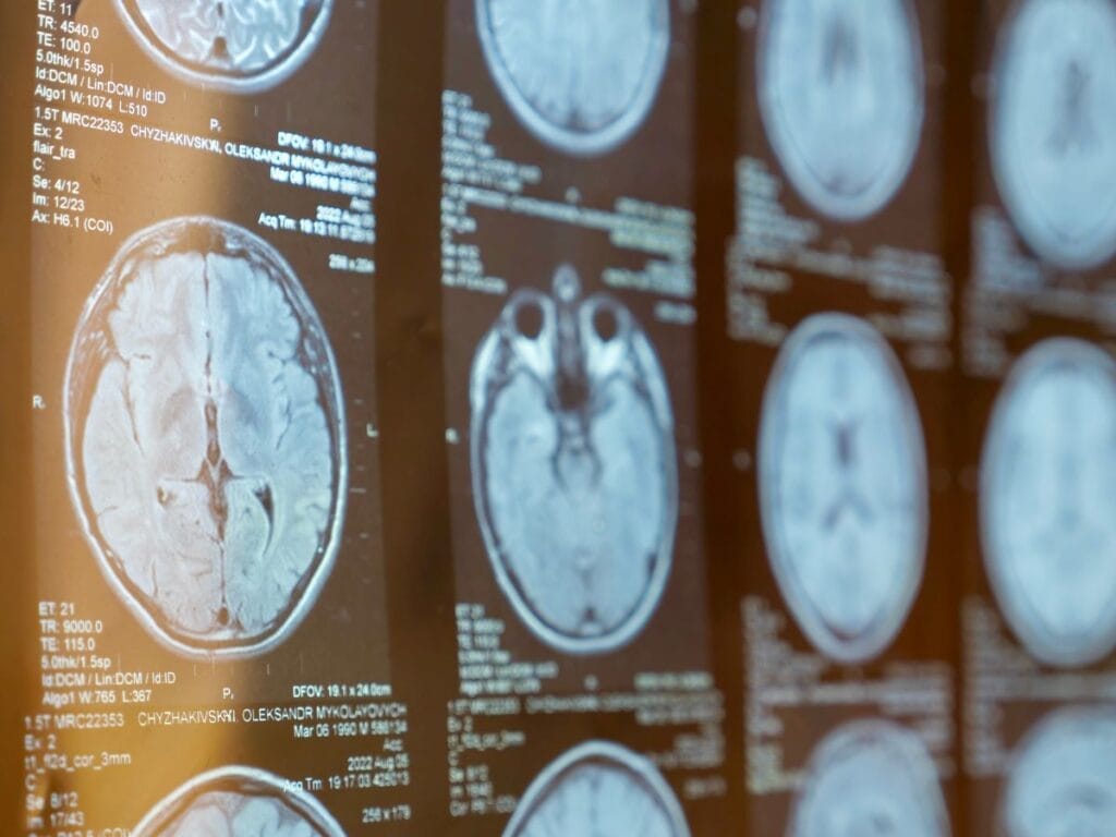 brain - welltica.dk - Vejen til et bedre liv