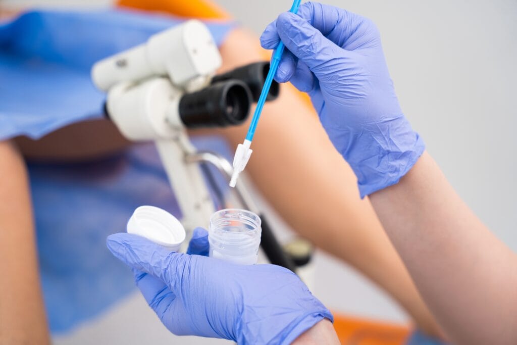 HPV, kræft, livmoder, undersøgelse - welltica.dk - Vejen til et bedre liv
