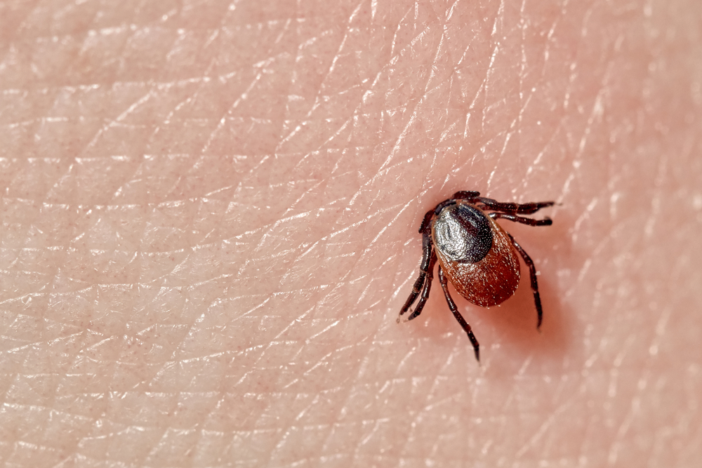 SuckingTickMacroPhotoOnHumanSkinIxodesRicinusBloated - welltica.dk - Vejen til et bedre liv