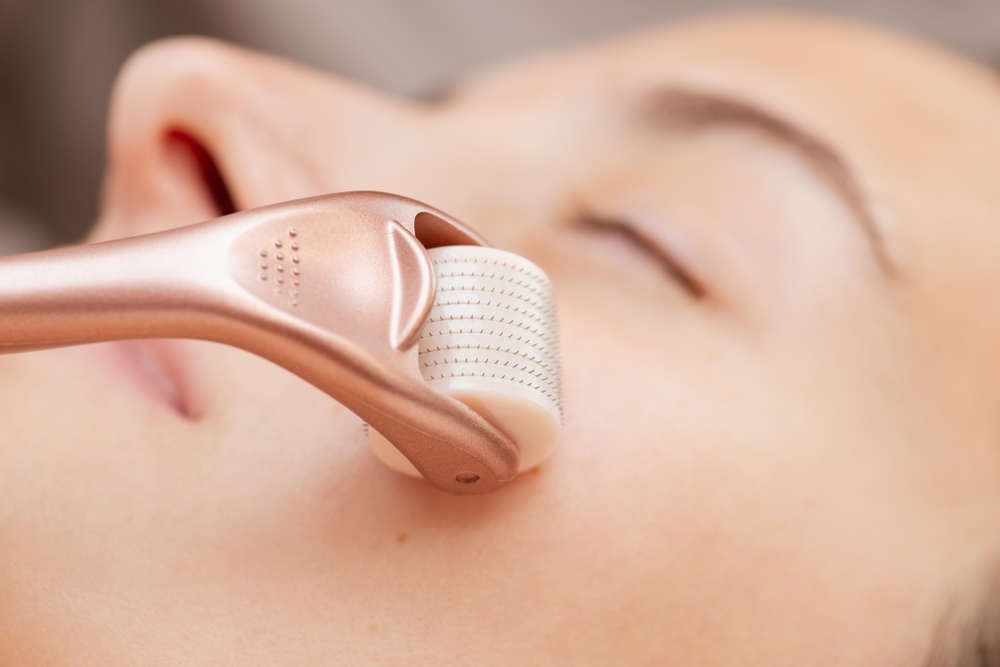 UsingRollerWithMicroNeedlesForStimulationOfSkinRegeneration - welltica.dk - Vejen til et bedre liv