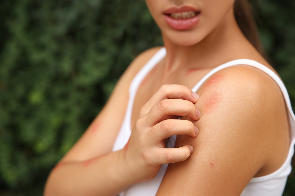 WomanScratchingShoulderWithInsectBiteOutdoorsCloseup - welltica.dk - Vejen til et bedre liv