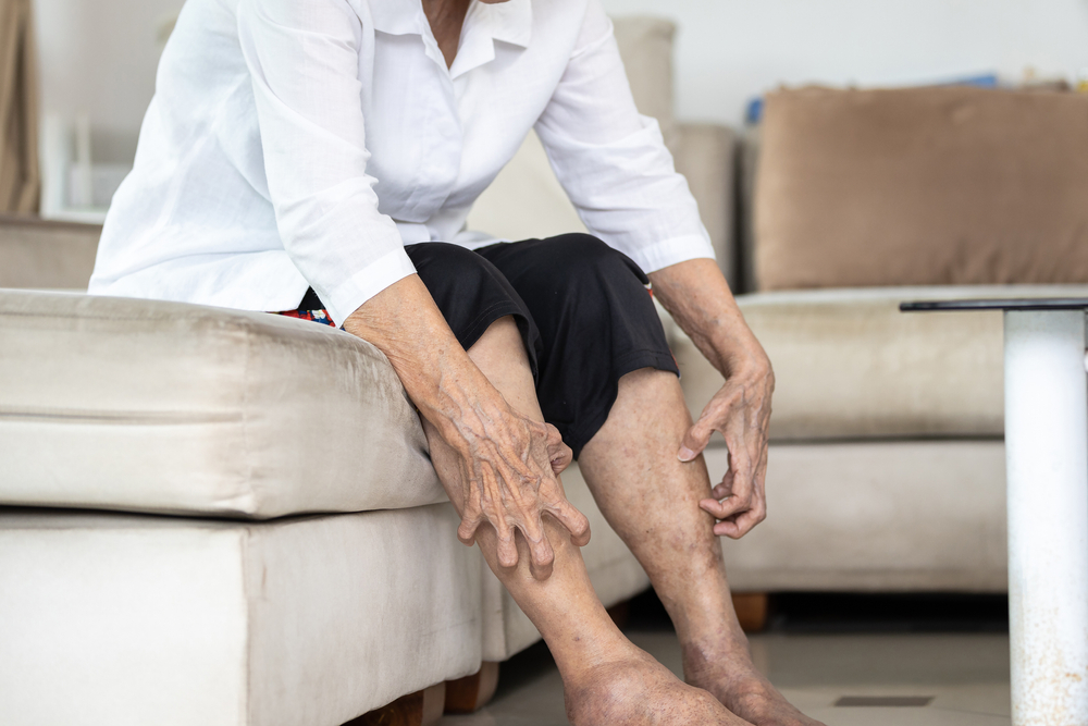HandsOfOldElderlyScratchingLegsitchingFromMosquitoesinsectBitesAllergy - welltica.dk - Vejen til et bedre liv