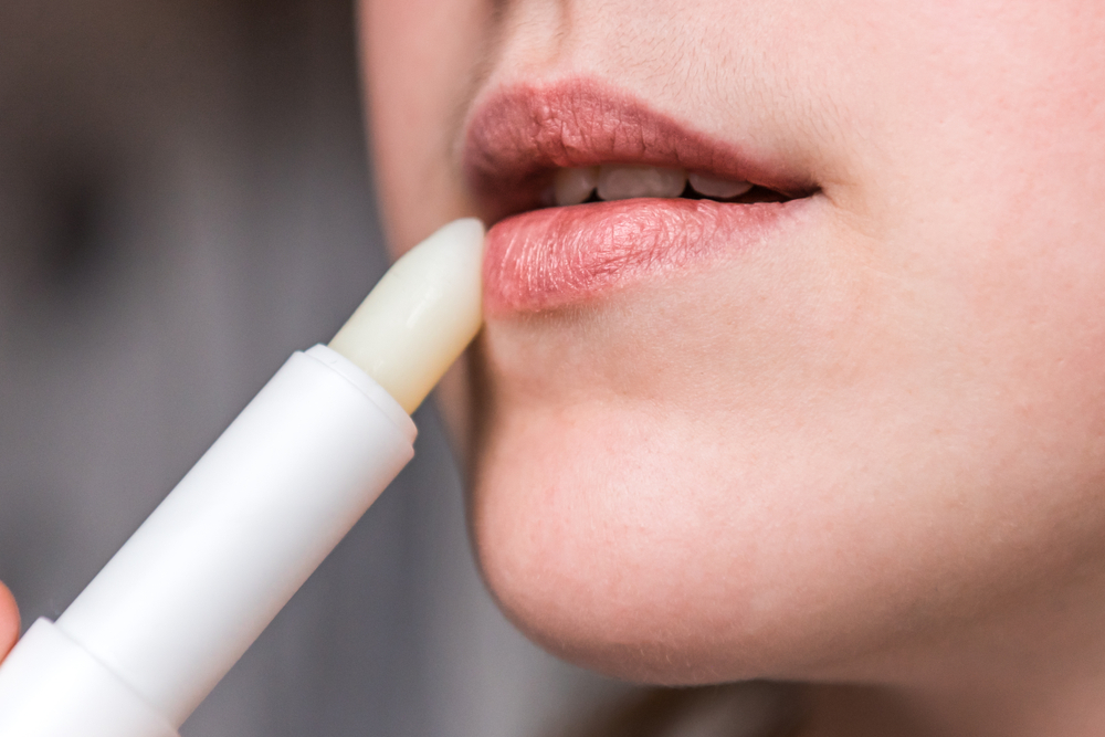 ChappedOrCrackedDryLipsThatHaveLostMoistureWoman - welltica.dk - Vejen til et bedre liv
