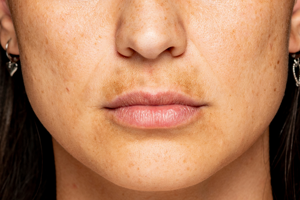MacroShotOfAFemaleFaceWithDarkSkinOn - welltica.dk - Vejen til et bedre liv