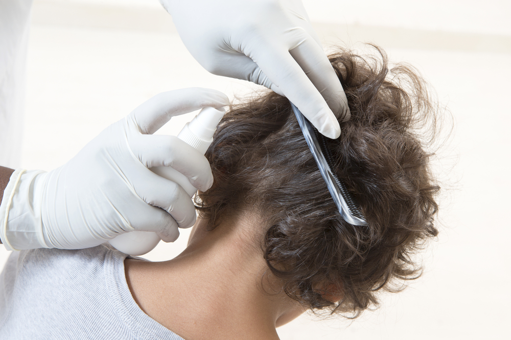 HeadLiceTreatment - welltica.dk - Vejen til et bedre liv