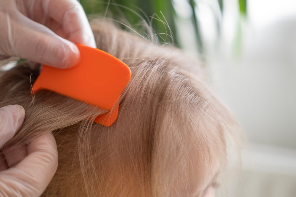 Close-upChildsHeadWithFemaleHandsSearchingForLiceAnd - welltica.dk - Vejen til et bedre liv