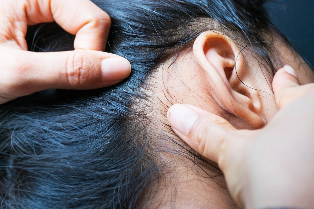 LiceOnHumanHair - welltica.dk - Vejen til et bedre liv