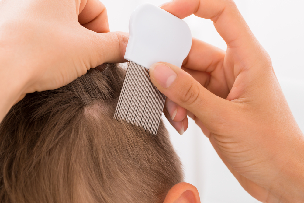 Close-upOfFemaleDoctorDoingTreatmentOnBoysHairWith - welltica.dk - Vejen til et bedre liv
