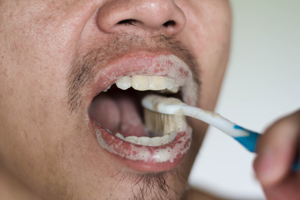 ManBrushingTeethWithHerbToothpasteInMorning - welltica.dk - Vejen til et bedre liv