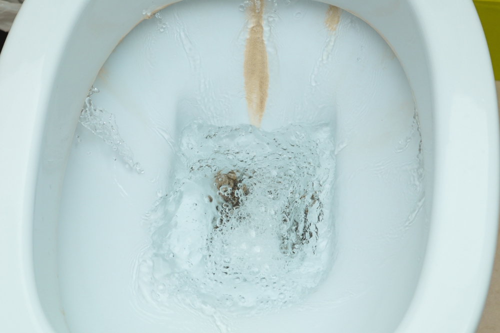 DirtyToiletBowlWithLimescaleStainDepositsAToiletWith - welltica.dk - Vejen til et bedre liv