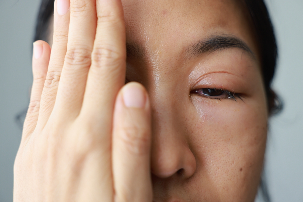 WomansEyesBecomeInflamedAfterRubbingHerEyesViolentlyInsects - welltica.dk - Vejen til et bedre liv