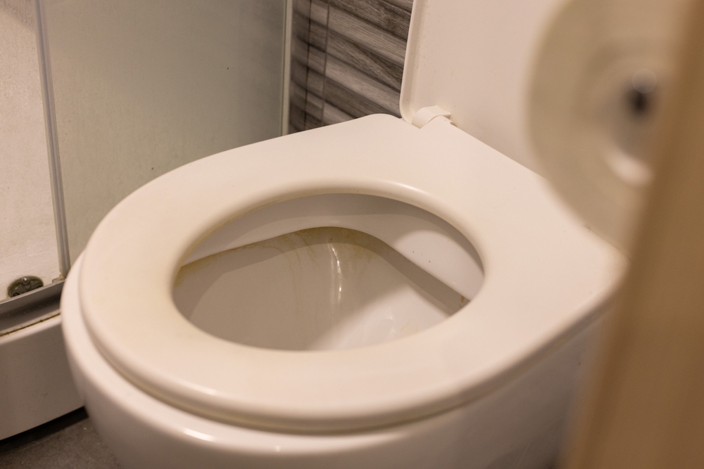 Close-upOfDirtyRimOfTheToiletBowl - welltica.dk - Vejen til et bedre liv