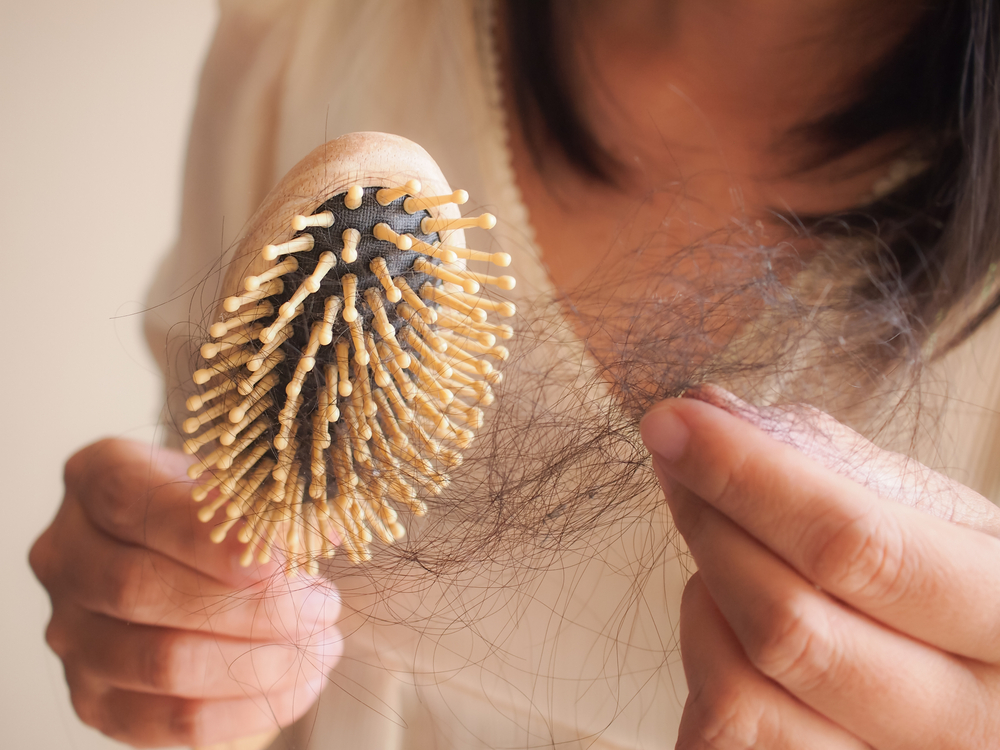 HealthcareConceptcloseupHairLosshairFallInHairbrushStressProblemOf - welltica.dk - Vejen til et bedre liv